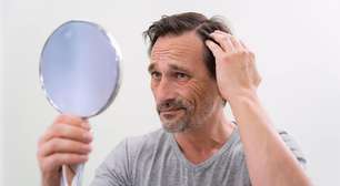Com que idade a calvície começa nos homens? Usar boné causa queda de cabelos?
