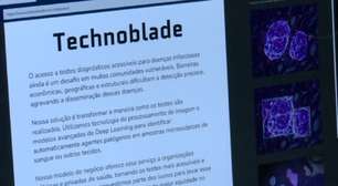 Brasileiro cria IA que ajuda a diagnosticar doença de chagas