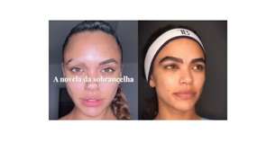 Calvície na sobrancelha: Giovana Cordeiro, de 'Dona de Mim', revela diagnóstico incomum por uso de muita química nos pelos; dermatologista explica
