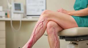 Saúde vascular: campanha alerta para cuidados