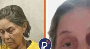 Defesa de idosa presa pelo "8 de Janeiro" denuncia tortura a orgãos internacionais