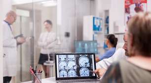 Aneurisma cerebral é silencioso e pode ser fatal