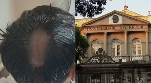 Estudante denuncia agressão homofóbica em festa universitária da UFRJ