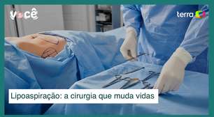 Lipoaspiração: da retirada de gordura ao contorno muscular, a cirurgia muda vidas