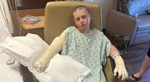 Menino de 12 anos fica internado após se queimar fazendo trend das redes sociais