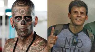 Homem que já foi o mais tatuado do Brasil mostra rosto após retirar tatuagens: 'Dignidade devolvida'