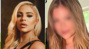 Luísa Sonza pode ter reduzido preenchimento labial; especialista explica efeitos da mudança