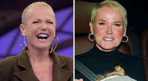Xuxa surge com cabelos volumosos seis meses após transplante; veja antes e depois