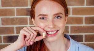 6 mitos e verdades sobre o dente do siso