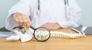 Toda fratura na coluna exige cirurgia? Entenda o assunto
