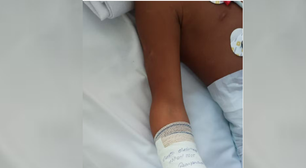 Menino perde a mão e dedos do pé após explosão de artefato no RJ