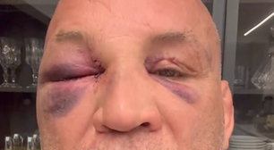 Wanderlei Silva diz que 'memória está voltando' após sair desacordado de confusão com equipe de Popó