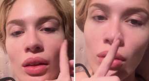 Após término com Léo Pereira, Karoline Lima explica por que está com os olhos roxos