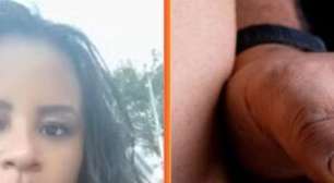 Mulher morre após aplicação de Mounjaro e enzimas em procedimento estético