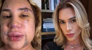 Influenciador morre aos 31 anos após complicações de procedimento estético