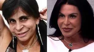 Gretchen detona quem fala sobre sua aparência