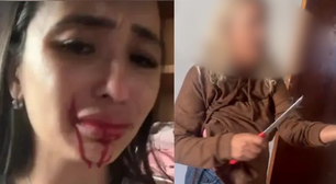 Imagens fortes! Ex-bailarina do Faustão é esfaqueada pela mãe usuária de crack: 'Tô cuspindo sangue'