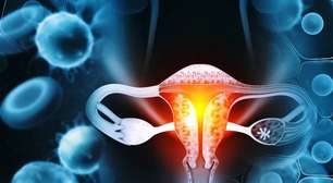 Câncer do colo do útero pode ser erradicado em 10 anos