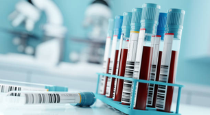 Exames de sangue podem detectar câncer precocemente