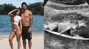 Gabriel Medina anuncia que será pai pela 1ª vez ao compartilhar ultrassom com bebê 'surfando'