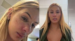 Influenciadora trans denuncia agressão dentro de adega no interior de SP: 'Desmaiei'