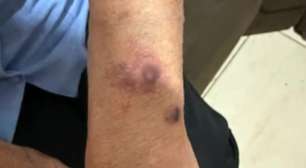 Filha é presa por agredir e manter mãe idosa em cárcere privado por cerca de dois meses no Paraná