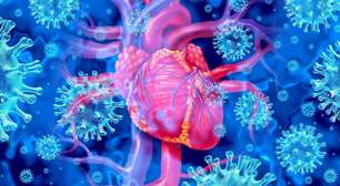 Miocardite: o que é, as causas, sintomas e tratamento