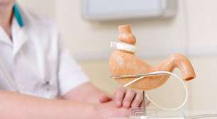 Cirurgia bariátrica reduz custos de saúde em pacientes com diabetes tipo 2