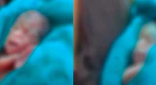 Bebê encontrado vivo durante velório no Acre morre após ficar 12 horas dentro de um saco