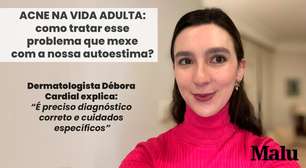 Acne adulta: por que ela surge? - Dermatologista Debora