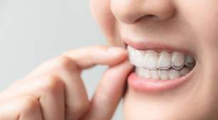 Saiba as vantagens e segredos do aparelho invisível