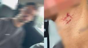 Polícia resgata 'escravo sexual' mantido em cárcere por homem apontado como traficante em Goiás