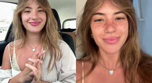 Tendência ou polêmica? Influenciadora tatua sardas no rosto e viraliza nas redes sociais