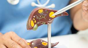 "A gordura do fígado não vem da gordura da comida": entenda o que é que você come que pode te levar a esse problema