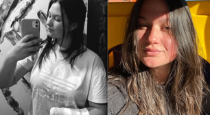 Jovem faz desabafo após ter mão amputada em ataque do ex-companheiro: 'Senti que era o meu fim'