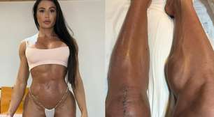 Gracyanne Barbosa mostra o corpo após lesão e cirurgia no Dança dos Famosos