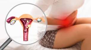 Trauma na infância está associado a maior risco de endometriose em mulheres adultas