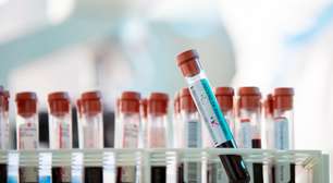 Exames de sangue podem indicar problemas no coração; saiba como