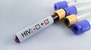 Descoberta histórica pode ser início do fim do HIV: cientistas alemães encontram anticorpo capaz de neutralizar quase todas as variantes do vírus
