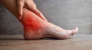 Como diminuir o ácido úrico: alimentação e tratamentos