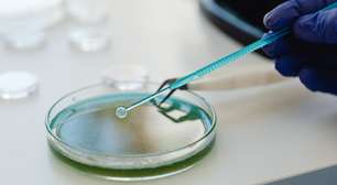 Você sabia que algumas bactérias são benéficas para o organismo? Entenda