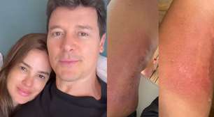 Vera Viel faz desabafo comovente sobre tratamento contra o câncer: 'Nunca imaginei'