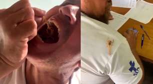 Servidores são flagrados 'brincando' com escorpiões em MG