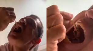 Servidores de MG brincam com escorpiões vivo e chegam a colocar animais dentro da boca