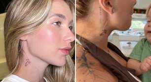 Virgínia mostra tatuagem machucada e especialista alerta: 'Remoção exige cuidado'