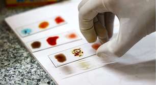 A magia do 'sangue dourado': como cientistas estão tentando cultivar tipo sanguíneo mais raro do mundo