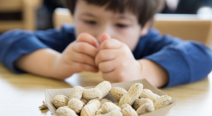 Exposição precoce reduz casos de alergia ao amendoim