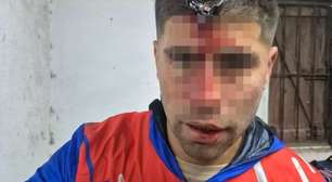 Jogador passa por cirurgia após ser atingido por chave de carro na testa
