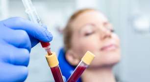 "Máscara menstrual": o que a ciência diz sobre a mais nova moda em beleza facial nas redes sociais