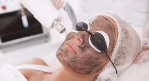 Conheça o Peeling de Hollywood e seus benefícios